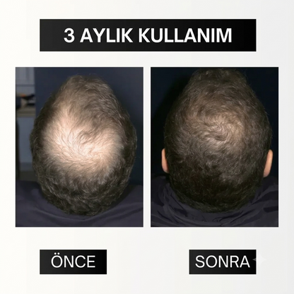 Full Set: Saçlarınıza Yeniden Hayat Verin – Kökten Uca Tam Bakım Paketi