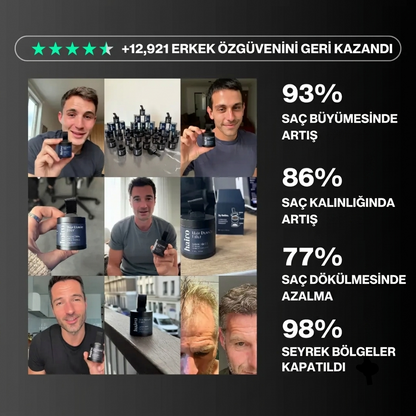 Full Set: Saçlarınıza Yeniden Hayat Verin – Kökten Uca Tam Bakım Paketi
