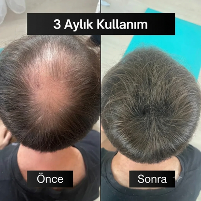 Full Set: Saçlarınıza Yeniden Hayat Verin – Kökten Uca Tam Bakım Paketi